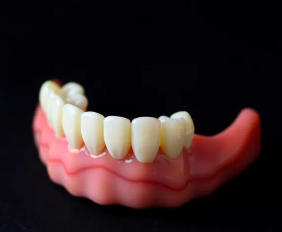 dental bridge photos