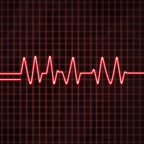 sinus rhythm with pjc