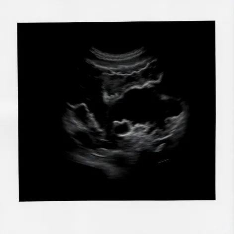 blank sonogram