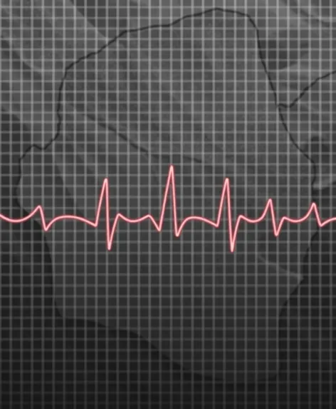 borderline ecg