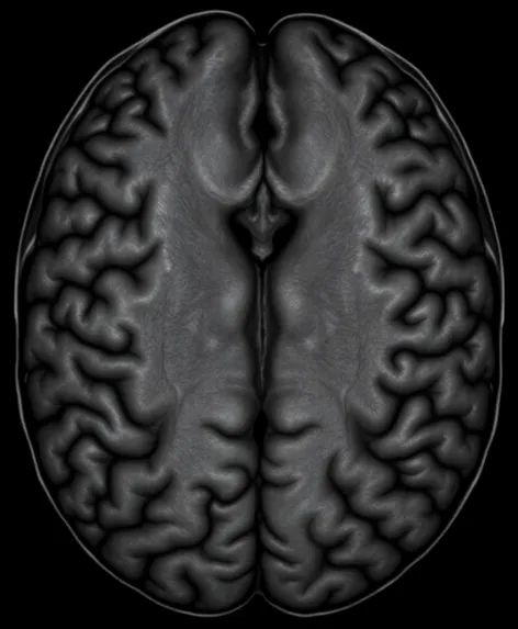 longitudinal cerebral fissure