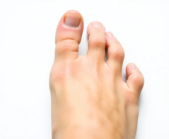 2nd toe longer than